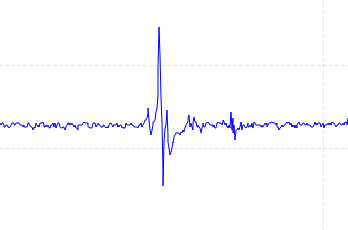 screenshot of EMG of a finger snap