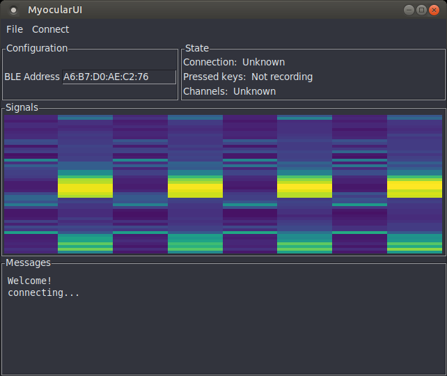 MyocularUI screenshot