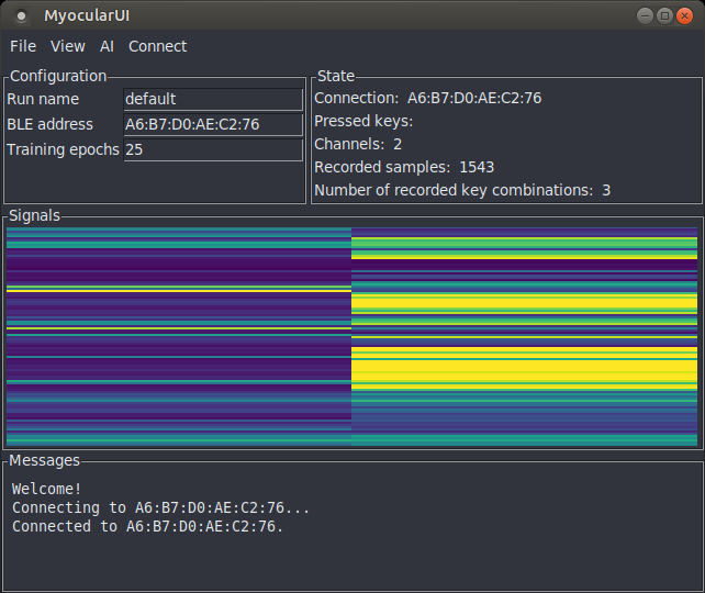 MyocularUI screenshot