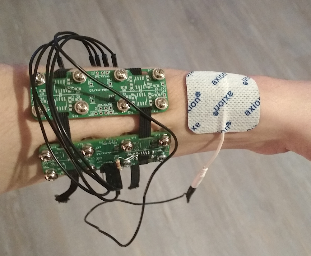 outside view with wet electrode