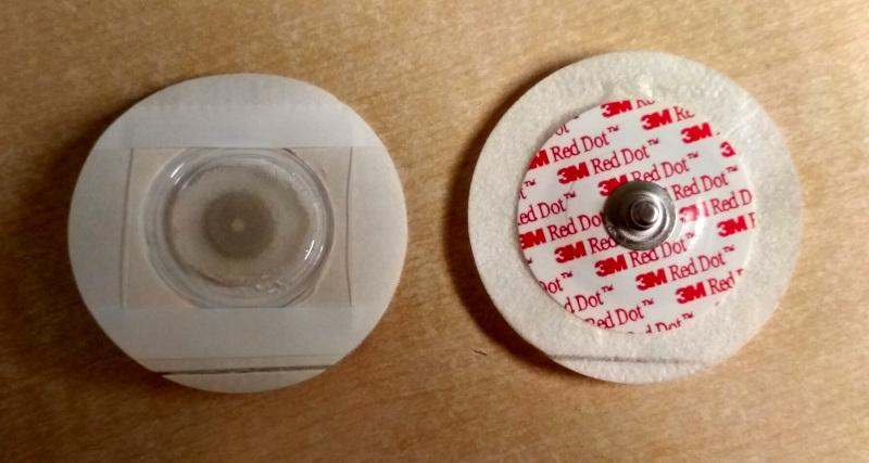 photo of the electrodes