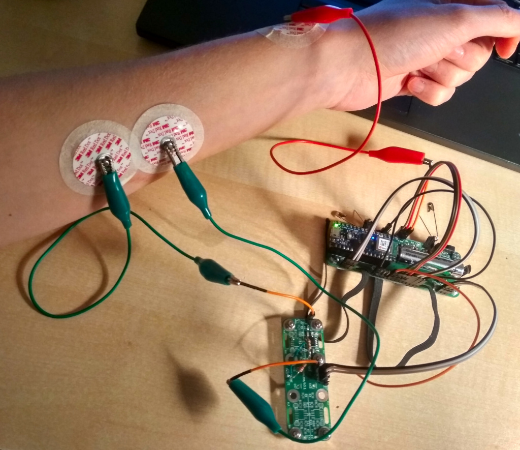 Photo of the electrodes on my skin